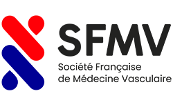 SFMV